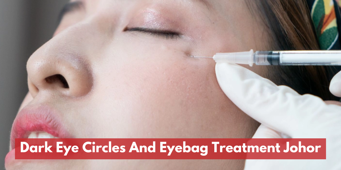 Dark Eye Circles And Eyebag Treatment Johor | Doctor-Led Care at Southern Pixel Clinic